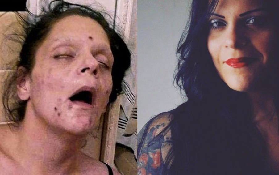 Mel Befor and after addiction picture